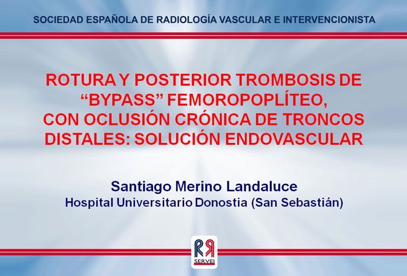 Rotura y posterior trombosis de “bypass” femoropoplíteo, con oclusión crónica de troncos distales: solución endovascular — diapositiva 1