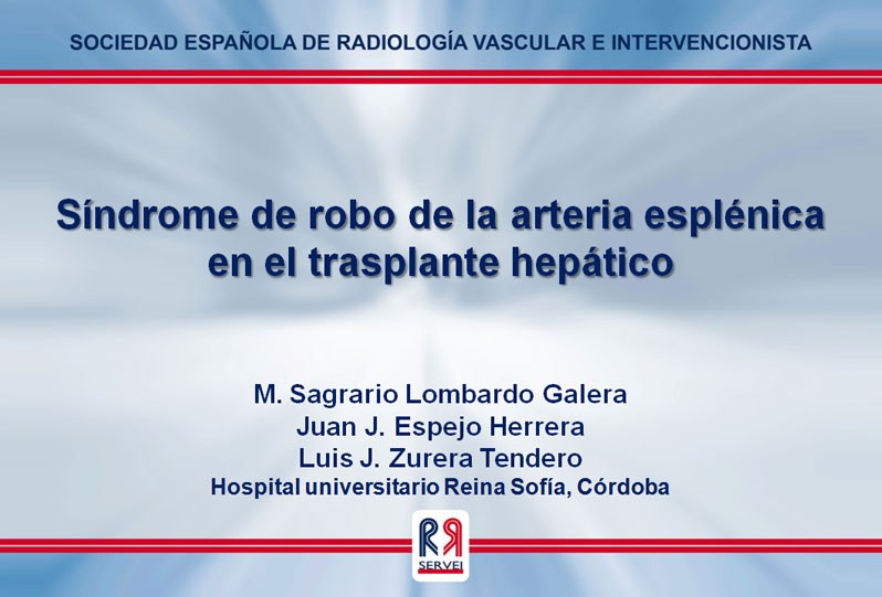 Síndrome de robo de la arteria esplénica en el trasplante hepático — diapositiva 1
