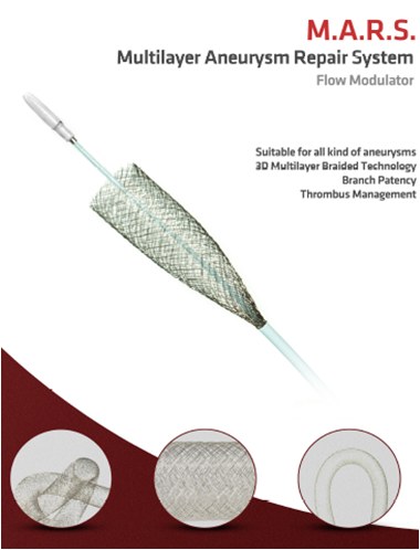 Utilidad del stent modulador de flujo en un caso de aneurisma de la arteria hepática — diapositiva 21